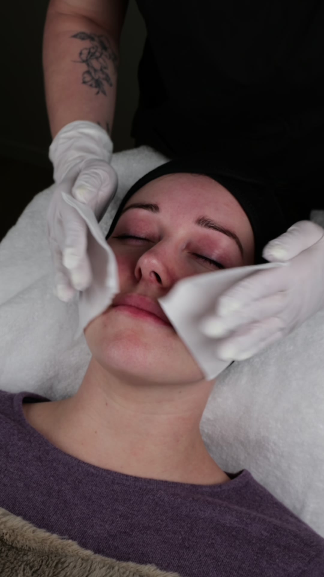 HydraFacial Tiefenreinigung bei Muse Body Shape Institute Wohlen